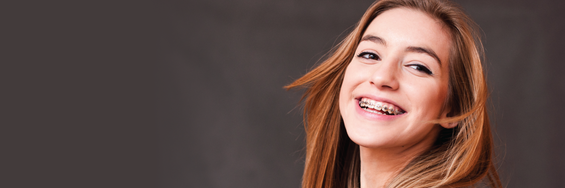 Orthodontist patient in Bondi Junction