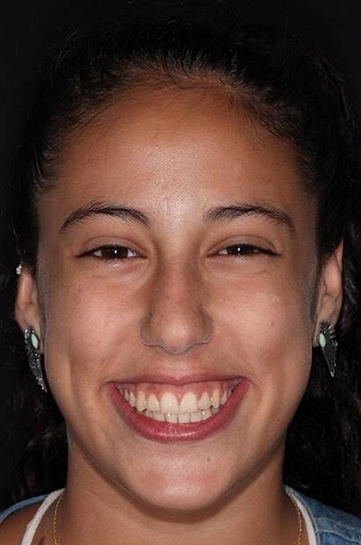 Ortho patient after pictures